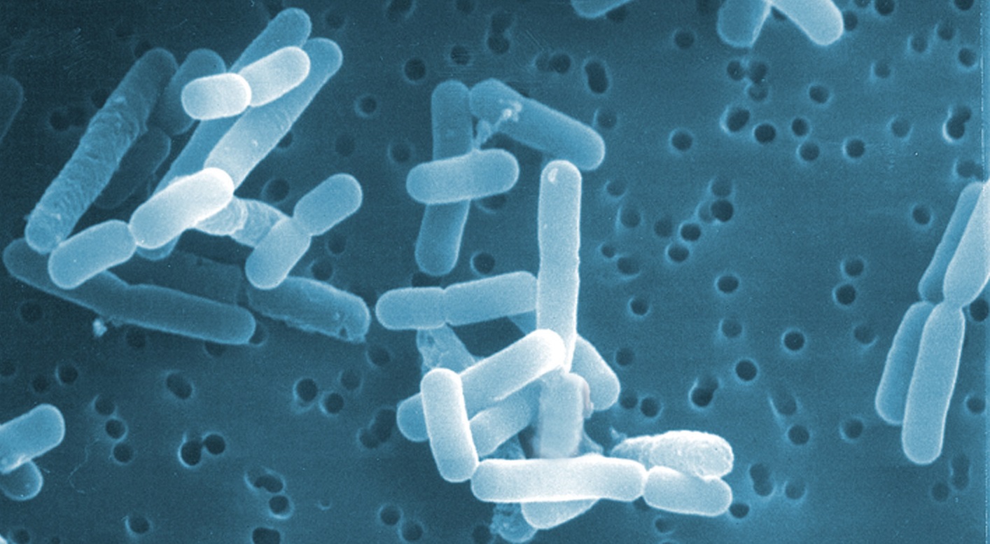 乳酸菌检验的计数方法与规则详解