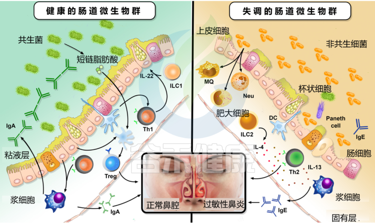 过敏性鼻炎 – 谷禾健康
