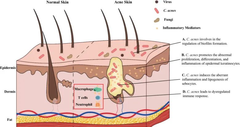皮肤屏障 – 谷禾健康
