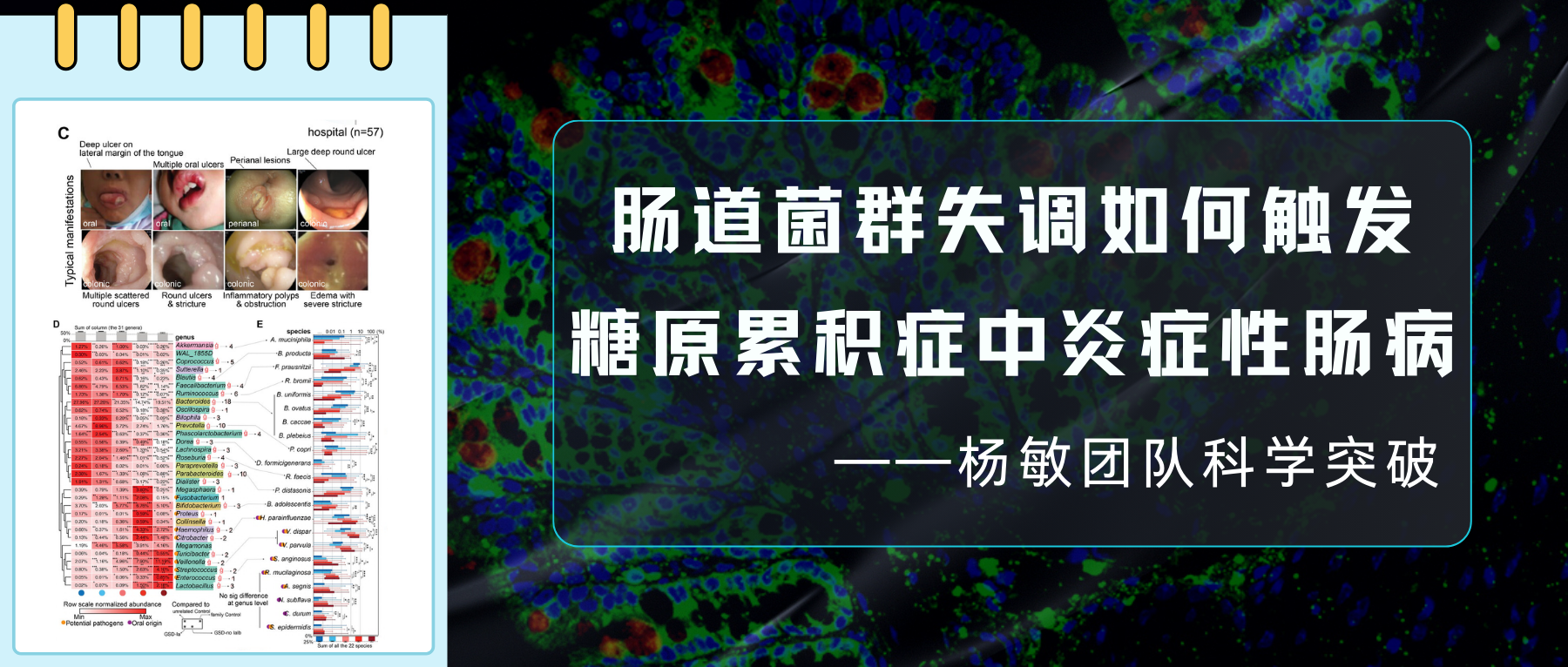 炎症性肠病– 谷禾健康