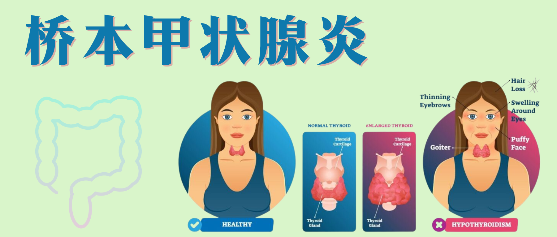 性自身免疫性疾病——桥本甲状腺炎，改变认知和抓住关键– 谷禾健康